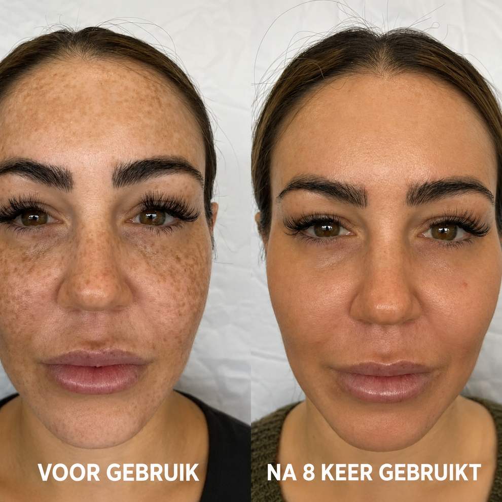 Dark spots and uneven skin tone