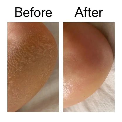 Beyond Berry Glycolic Acid Body Stick